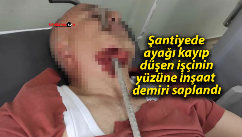 İnşaat demiri boynundan girip yanağından çıktı