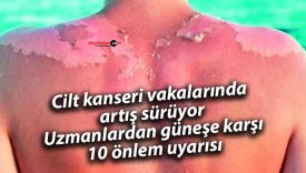 Cilt kanseri vakalarında artış sürüyor: Uzmanlardan güneşe karşı 10 önlem uyarısı