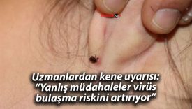 Uzmanlardan kene uyarısı: “Yanlış müdahaleler virüs bulaşma riskini artırıyor”
