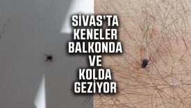 Sivas’ta kene alarmı! Vatandaşlar balkonlarında ve kollarında kene buldu