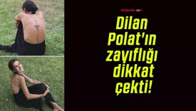 Dilan Polat’ın zayıflığı dikkat çekti!