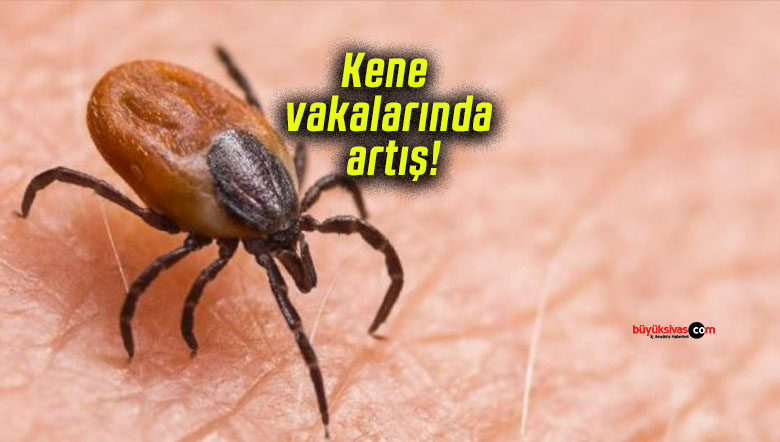 Kene vakalarında artış!