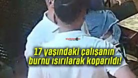 17 yaşındaki çalışanın burnu ısırılarak koparıldı!