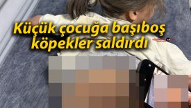 Küçük çocuğa başıboş köpekler saldırdı