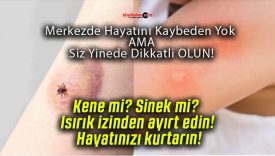 Kene mi? Sinek mi? Isırık izinden ayırt edin! Hayatınızı kurtarın!