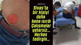 Sivas’ta bayram için memleketine gelen vatandaşı kene ısırdı!