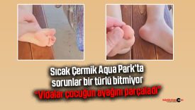 Sıcak Çermik Aqua Park! “Vidalar ayağımızı kesti, kimse ilgilenmedi”