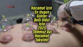 Hacamat İçin En Uygun Günler Belli Oldu! İşte 2025 Temmuz Ayı Hacamat Takvimi!