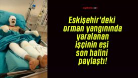 Eskişehir’deki orman yangınında yaralanan işçinin eşi son halini paylaştı!