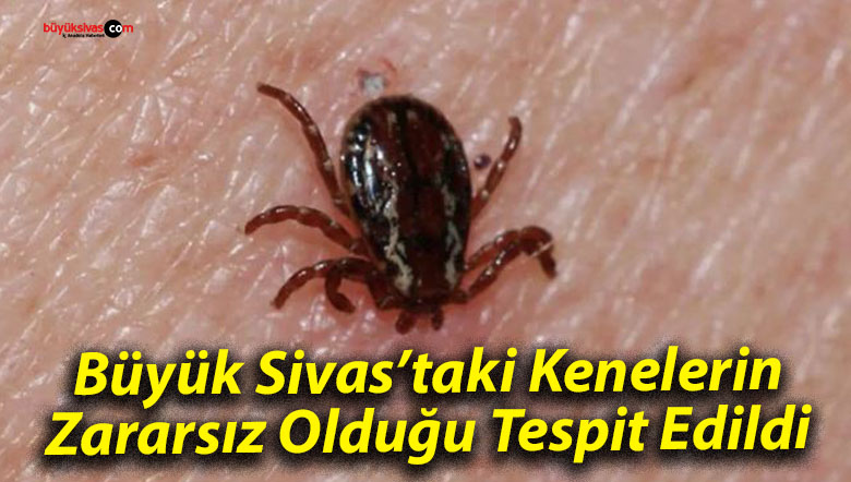 Büyük Sivas’taki Kenelerin Zararsız Olduğu Tespit Edildi