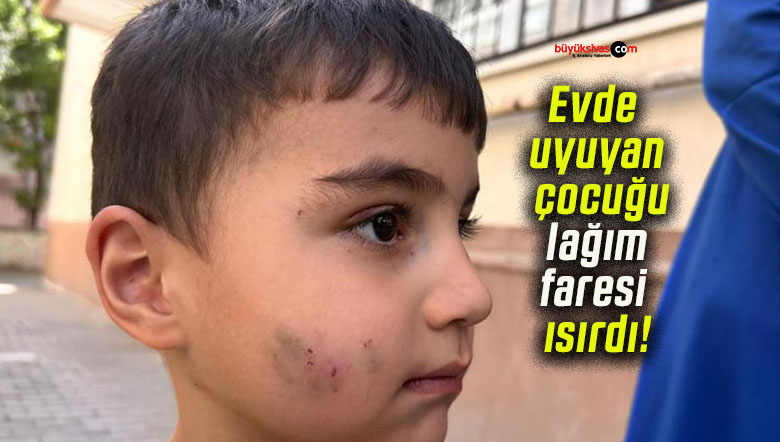 Evde uyuyan çocuğu lağım faresi ısırdı!