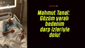 Mahmut Tanal: Gözüm yaralı bedenim darp izleriyle dolu!
