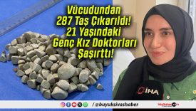 Vücudundan 287 Taş Çıkarıldı! 21 Yaşındaki Genç Kız Doktorları Şaşırttı!