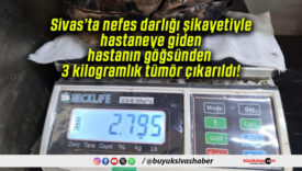 Sivas’ta nefes darlığı şikayetiyle hastaneye giden hastanın göğsünden 3 kilogramlık tümör çıkarıldı!