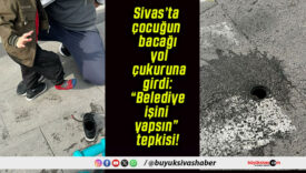 Sivas’ta çocuğun bacağı yol çukuruna girdi: “Belediye işini yapsın” tepkisi!