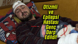 Otizmli ve Epilepsi Hastası Genç Darp Edildi!