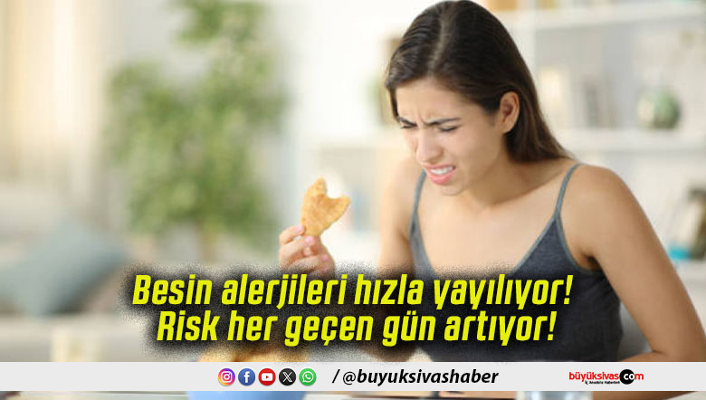 Besin alerjileri hızla yayılıyor! Risk her geçen gün artıyor!