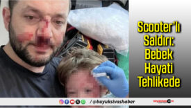 Scooter’lı Saldırı