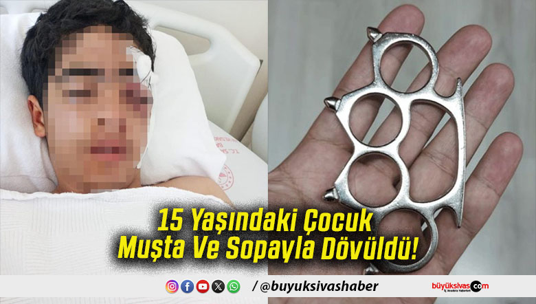 15 Yaşındaki Çocuk Muşta Ve Sopayla Dövüldü!