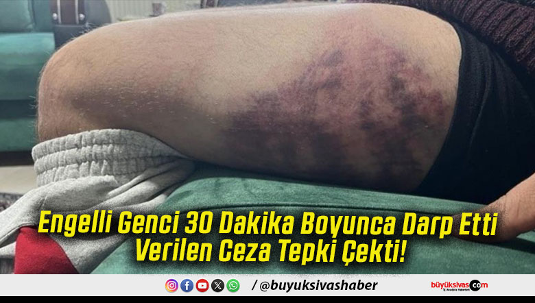 Engelli Genci 30 Dakika Boyunca Darp Etti Verilen Ceza Tepki Çekti!