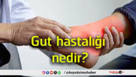 edir