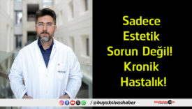 değas