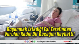 Boşanmak İstediği Eşi Tarafından Vurulan Kadın Bir Bacağını Kaybetti!
