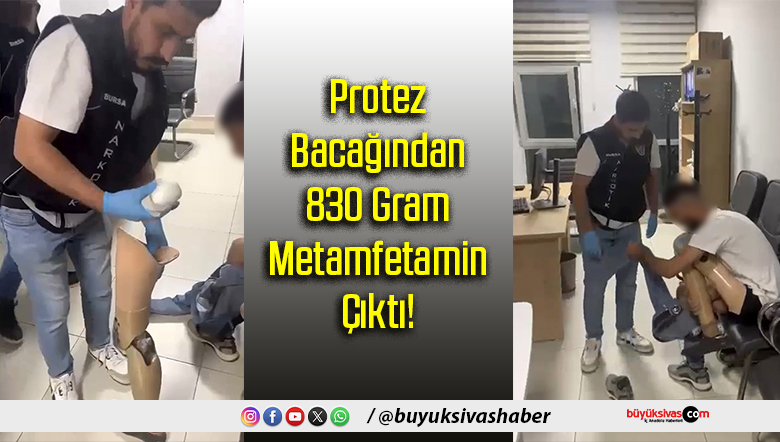 Protez