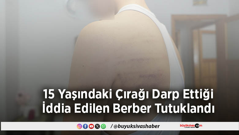 Çırağı Darp Ettiği