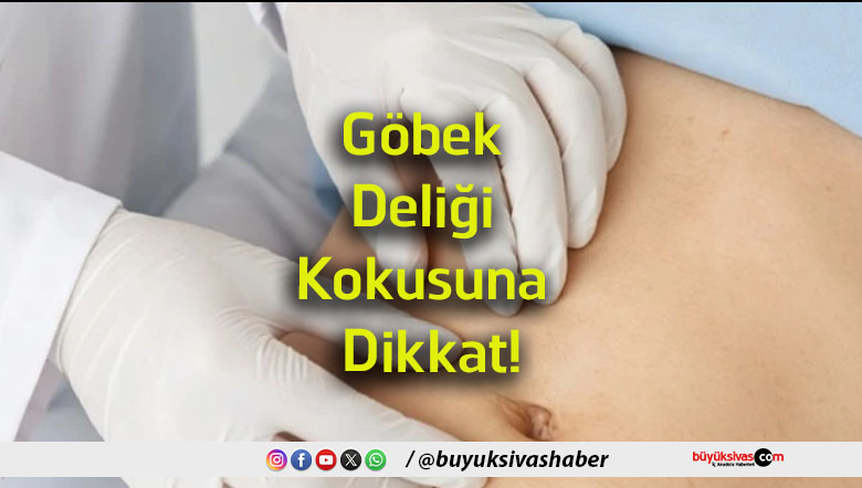 kokusu