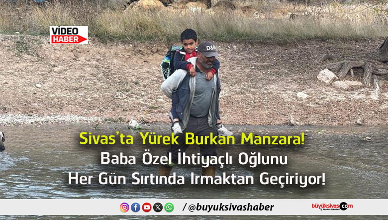 manzara